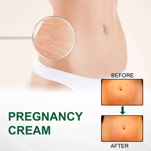 HM1760 Crème anti-<span class=keywords><strong>vergeture</strong></span> biologique pour la réparation de la peau Anti-<span class=keywords><strong>vergeture</strong></span> pour la réparation des cicatrices de grossesse Crème anti-vergetures - Product Image 4