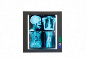 Y tế LED duy nhất đôi X-Ray phim xem Illuminator ánh sáng người xem - Product Image 2