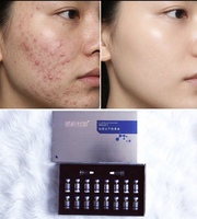 Sérum pour lutter contre l'acné, anti-rides, anti-âge, éclaircissant, resserrant les pores, à la glycérine, pour usage domestique