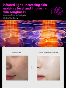 Facial <strong>Mask</strong> 4 Colors <strong>LED</strong> <strong>Light</strong> Red <strong>Light</strong> <strong>Treatment</strong> <strong>LED</strong> Facial <strong>Mask</strong> Silicone <strong>LED</strong> Near Infrared <strong>Light</strong> Facial <strong>Mask</strong> Facial Beauty