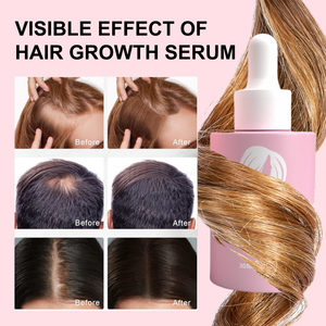 Großhandel Kräuter-Multi-Peptid Haarwuchsöl Private Label Natürliches Organisches Biotin Haarwachstumsserum - Product Image 6