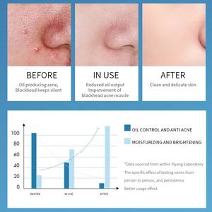 Limpiador <span class=keywords><strong>facial</strong></span> <span class=keywords><strong>para</strong></span> hombre OEM, sin jabón, Control de aceite, <span class=keywords><strong>limpieza</strong></span> suave, cuidado de la piel natural <span class=keywords><strong>para</strong></span> hombre, lavado <span class=keywords><strong>facial</strong></span> de barro volcánico con aminoácidos <span class=keywords><strong>para</strong></span> hombre - Product Image 5