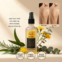 Tonique en spray pour le dos et le corps à l'huile d'eucalyptus et à l'hamamélis, marque privée
