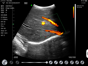 192 Elementen Vasculaire Doppler Draadloze Convexe Ultrasone Sonde - Product Image 5