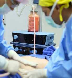 Sonda de Liposucción Vaser Cánula Vaser Lipoescultura Cánula Vaser - Product Image 1