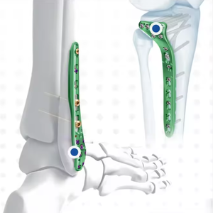 <span class=keywords><strong>Vis</strong></span> à os pour pieds, plaques de fixation pour fractures de la <span class=keywords><strong>cheville</strong></span> - Product Image 2