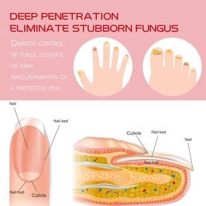 Solución Reparadora de <span class=keywords><strong>Uñas</strong></span> South Moon Herbal 20ml, Limpia, Blanquea y Nutre <span class=keywords><strong>las</strong></span> <span class=keywords><strong>Uñas</strong></span>, Cuidado Antifúngico <span class=keywords><strong>para</strong></span> <span class=keywords><strong>Uñas</strong></span> de los Pies, Paquete Individual - Product Image 4