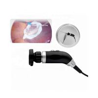 Caméra d'endoscopie médicale USB portable, caméra de microscope à monture C pour équipement de diagnostic vétérinaire, capteur HDMI, caméra d'endoscopie