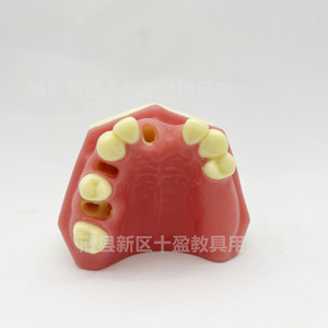 แบบจำลองฟันปลอมชิอิง รุ่น Pim-21 ทำจากเรซิ่น สำหรับฝึกปฏิบัติทางการแพทย์วิทยาศาสตร์ ช่องปากส่วนหนึ่ง - Product Image 4