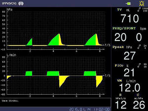 أدوات التخدير في المستشفى سعر جهاز التخدير - Product Image 6