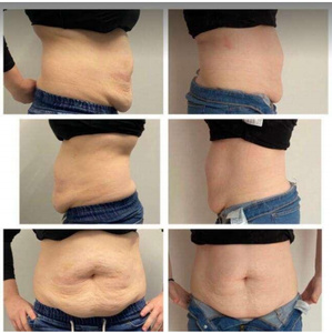 Machine de perte de graisse <span class=keywords><strong>non</strong></span> <span class=keywords><strong>invasive</strong></span> à prix de gros, Lipo Laser 6D avec 8 plaques, remodelage corporel, laser diode 650&780&980nm - Product Image 6