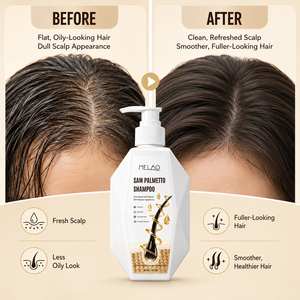 Commercio all'ingrosso olio di controllo nutriente rafforzamento Anti perdita di capelli Ginseng <span class=keywords><strong>Shampoo</strong></span> per la crescita dei capelli uomini donne attivatore di radici <span class=keywords><strong>Shampoo</strong></span> - Product Image 6