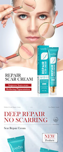 Crème réparatrice de cicatrices puissante et respirante à base de plantes, la plus vendue, <span class=keywords><strong>pour</strong></span> une cicatrisation rapide des cicatrices du corps et des bras, douce et non irritante, en stock - Product Image 6