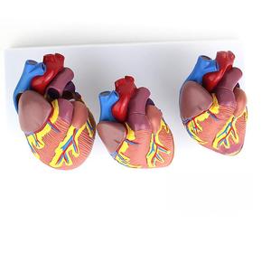 Modèle <span class=keywords><strong>de</strong></span> comparaison du cœur humain sain <span class=keywords><strong>et</strong></span> malade en 3 pièces, modèle d'enseignement <span class=keywords><strong>de</strong></span> l'anatomie des lésions cardiaques pour l'éducation en classe <span class=keywords><strong>de</strong></span> biologie - Product Image 2