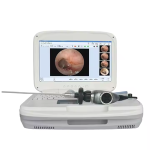 Endoscópio Sinoscópio Rígido <span class=keywords><strong>IKEDA</strong></span> 4mm para Cirurgia do Seio e Procedimentos ORL - Product Image 6