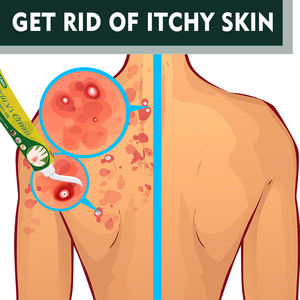 शरीर न्यूरोडर्मेटाइटिस के लिए एंटी-खुजली क्रीम चीन में निर्मित सभी प्रकार की त्वचा को राहत - Product Image 2