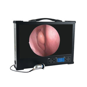 ระบบการส่องกล้อง1080P HD ระบบทางเดินปัสสาวะใหม่ - Product Image 1