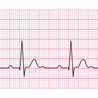 Papier thermique ECG/EKG en gros, 12 canaux, 80 mm x 25 m