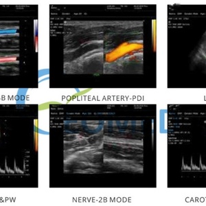 Appareil de diagnostic échographique numérique complet intelligent et puissant pour l'abdomen, dispositif vétérinaire BW21A - Product Image 6