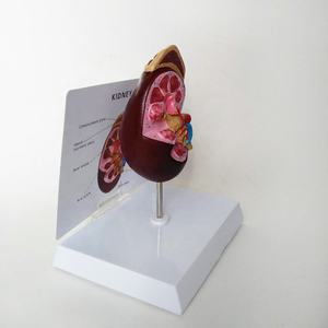 Modelo anatómico de enseñanza de ciencia médica, modelo de disección de riñón humano, modelo educativo de órganos, estructura anatómica de riñón - Product Image 4