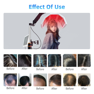 5 en 1 Analyseur de croissance des cheveux Machine Oxygénothérapie Appareils de massage du cuir chevelu Spa capillaire pour <span class=keywords><strong>la</strong></span> perte de cheveux - Product Image 5