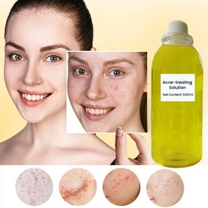 Nhà Máy Số Lượng Lớn Sản Phẩm Chăm Sóc Da Cho Mụn Trứng Cá Điều Trị Loại Bỏ Huyết Thanh Chống Mụn Trứng Cá Mụn Vá Mụn Trứng Cá Cho Khuôn Mặt Chăm Sóc Cho Mụn Trứng Cá - Product Image 1