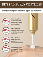 Crème réparatrice intensive pour cicatrices, atténuant les chéloïdes et les cicatrices hypertrophiques, restauration cutanée, marque privée, OEM ODM