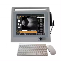Retiwave 1000 máquina de ultrasonido oftálmico a Scan Oftalmología AB Scanner