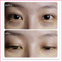 Usine de marque privée Anti-rides Microneedle Gel pour les yeux masque Gel pour les yeux Patch acide hyaluronique MicroNeedle Patch pour les yeux ventre minceur