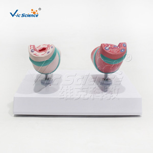 Suministro directo de fábrica de modelos de patología traqueal, hechos de material de PVC ecológico, claramente identificados, para laboratorio. - Product Image 5