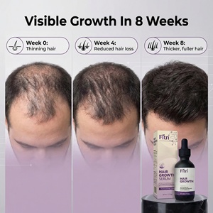 Aceite para el Crecimiento del Cabello de Marca Privada, Natural y Orgánico, con Romero y Menta, Tratamiento Rápido para el Cuero Cabelludo, Logotipo Personalizado OEM, Suministro Directo de Fábrica al por Mayor - Product Image 4