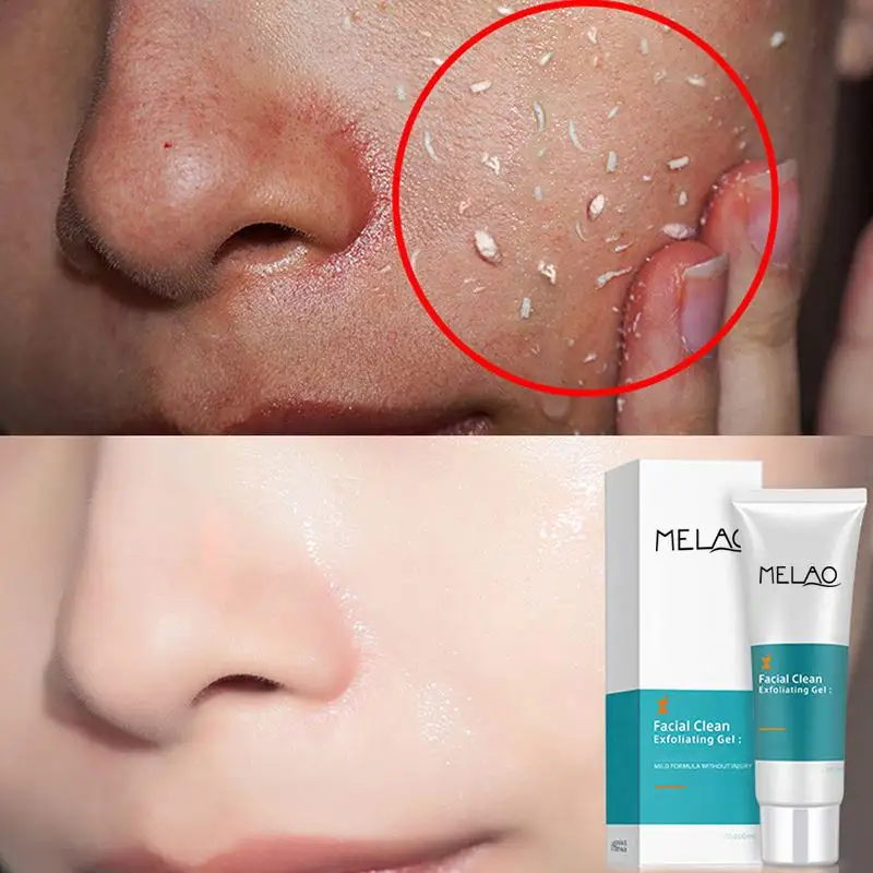 Crema Exfoliante para eliminación de piel muerta, Gel Exfoliante de limpieza profunda para cara, limpieza hidratante suave