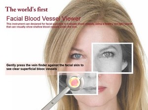 Localizador de Venas Infrarrojo Portátil, Visor de Venas, Detector de Venas - Product Image 4