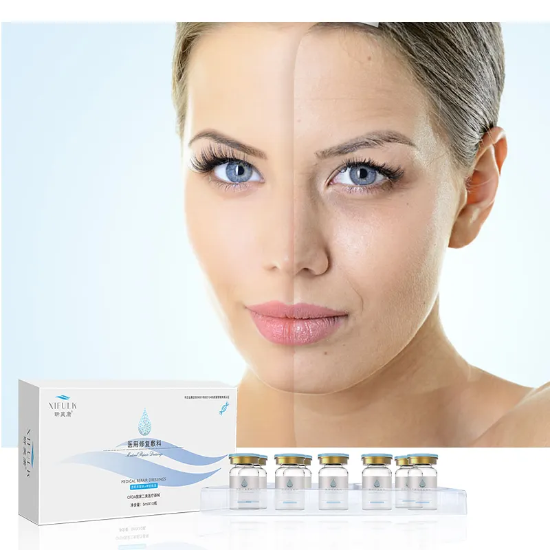 Juyou Groothandel Prijs Mesotherapie Behandeling Anti Rimpel Verstevigende Hyaluronzuur 5Ml * 10 Flessen Gezicht Serum