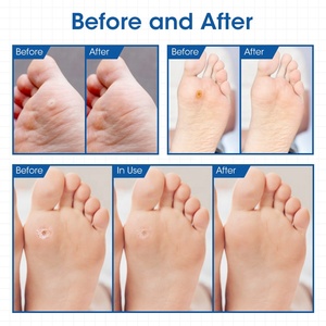 <span class=keywords><strong>Cerotti</strong></span> per Rimozione Calli MQ all'Ingrosso, 24 Pezzi/Scatola, Cuscinetti per Rimozione Calli, <span class=keywords><strong>Cerotti</strong></span> per Piedi - Product Image 2