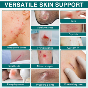 Perban Hidrokoloid ELAIMEI untuk Perawatan Luka, Fleksibel, Tahan Air, Bernapas, Kelas Medis, Perekat Sendiri, Gulungan - Product Image 2
