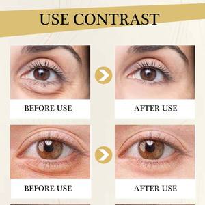 Crème pour les yeux infusée à la glycérine : pour un nettoyage en profondeur quotidien, purifiant, élimine en douceur les impuretés, réduit les <span class=keywords><strong>milia</strong></span>, les cernes et les poches - Product Image 6