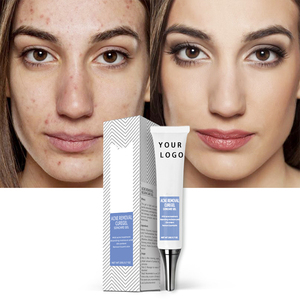 Label privé 20G Gel <span class=keywords><strong>de</strong></span> traitement <span class=keywords><strong>pour</strong></span> l'élimination <span class=keywords><strong>de</strong></span> l'acné végétalien Gel <span class=keywords><strong>pour</strong></span> soins <span class=keywords><strong>de</strong></span> <span class=keywords><strong>la</strong></span> <span class=keywords><strong>peau</strong></span> contre l'acné - Product Image 2