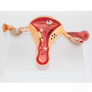 Model pengajaran medis Model anatomi ologis & petrokimia manusia untuk pendidikan ginekologi - Product Image 4