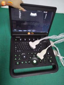 Mesin USG Digital Portabel SUN-800C untuk Kehamilan, Rumah Sakit, dan Ekokardiografi - Product Image 6