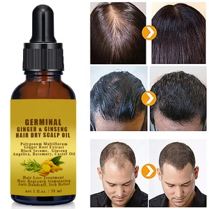 Trattamento Anticaduta e Antiforfora, Siero Germogliante allo Zenzero e Ginseng per 7 Giorni, Olio Nutriente per Massaggio del Cuoio Capelluto e Ricrescita dei Capelli - Product Image 3