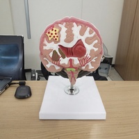 Modèle médical de pathologies cérébrales, modèle anatomique de maladies du cerveau pour l'enseignement médical, affichage des structures pathologiques, CE ROHS ISO
