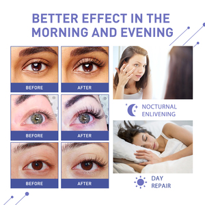 Sérum pour les cils Offre Spéciale améliorer l'huile de cils plus épaisse à base de plantes femme traitement de beauté sérum de croissance des cils - Product Image 6