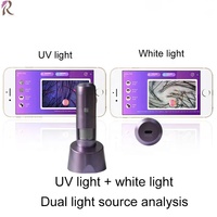 Analyseur de cuir chevelu de qualité, appareil de diagnostic capillaire, microscope capillaire numérique, analyseur de cuir chevelu USB, microscope capillaire