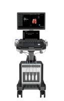 Appareil de diagnostic à ultrasons couleur sur chariot – Scanner d'échographie exclusif portable 3D/4D/5D – Équipement médical d'échographie