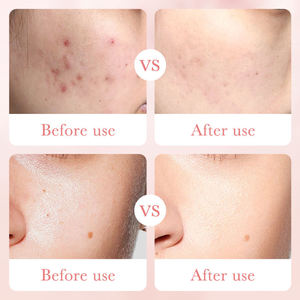 Ensemble de soins de la <span class=keywords><strong>peau</strong></span> à la rose BIOAQUA, marque privée, nettoyant <span class=keywords><strong>visage</strong></span> rose, tonique, sérum, crème anti-âge pour une utilisation quotidienne à domicile, cadeau - Product Image 6