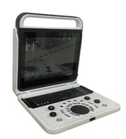 Ecógrafo Portátil en Blanco y Negro Mindray BOU50B para Diagnóstico Médico