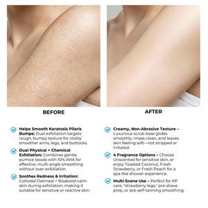 <span class=keywords><strong>Exfoliante</strong></span> Corporal Natural <span class=keywords><strong>de</strong></span> Frutas OEM, <span class=keywords><strong>Exfoliante</strong></span> <span class=keywords><strong>de</strong></span> Azúcar con Manteca <span class=keywords><strong>de</strong></span> Karité y Vitamina E, Hidratante y Suavizante <span class=keywords><strong>para</strong></span> <span class=keywords><strong>la</strong></span> Piel - Product Image 5