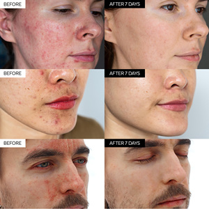 Crema Reparadora de Aloe Vera y Cica, Brillo Saludable, Cuidado Diario, Brillo Suave Ecológico, Botánica, Antienvejecimiento, Sin Sulfatos, Para Piel Sensible - Product Image 3