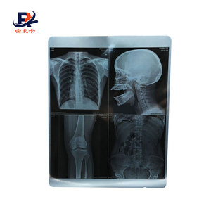 Film radiographique <span class=keywords><strong>dentaire</strong></span> <span class=keywords><strong>panoramique</strong></span> Offre Spéciale - Product Image 1